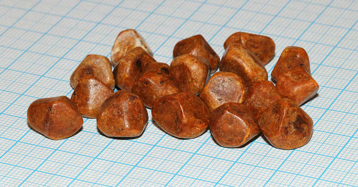 Como eliminar pedra na vesícula naturalmente