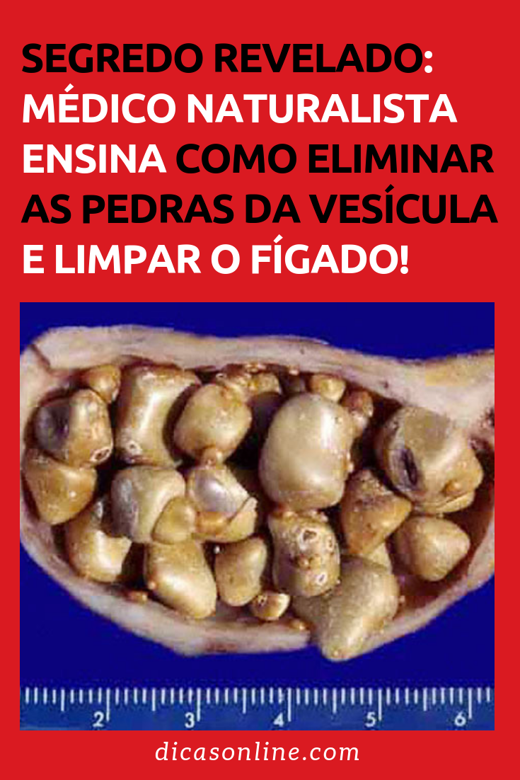 Remédio caseiro para pedra na vesicula biliar #DicasOnline #Dicas #Truques #RemediosNaturais #TratamentoCaseiro #CurasNaturais #RemediosCaseiros #TratamentosNaturais #PedraNaVisicula