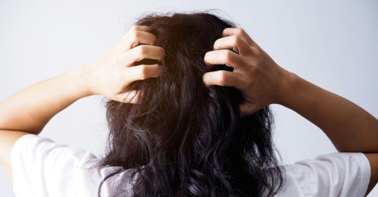 couro cabeludo sensível