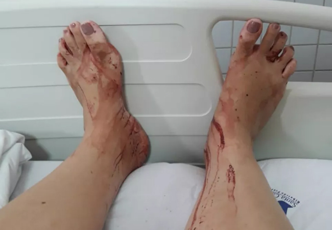 deu à luz em banheiro da santa casa