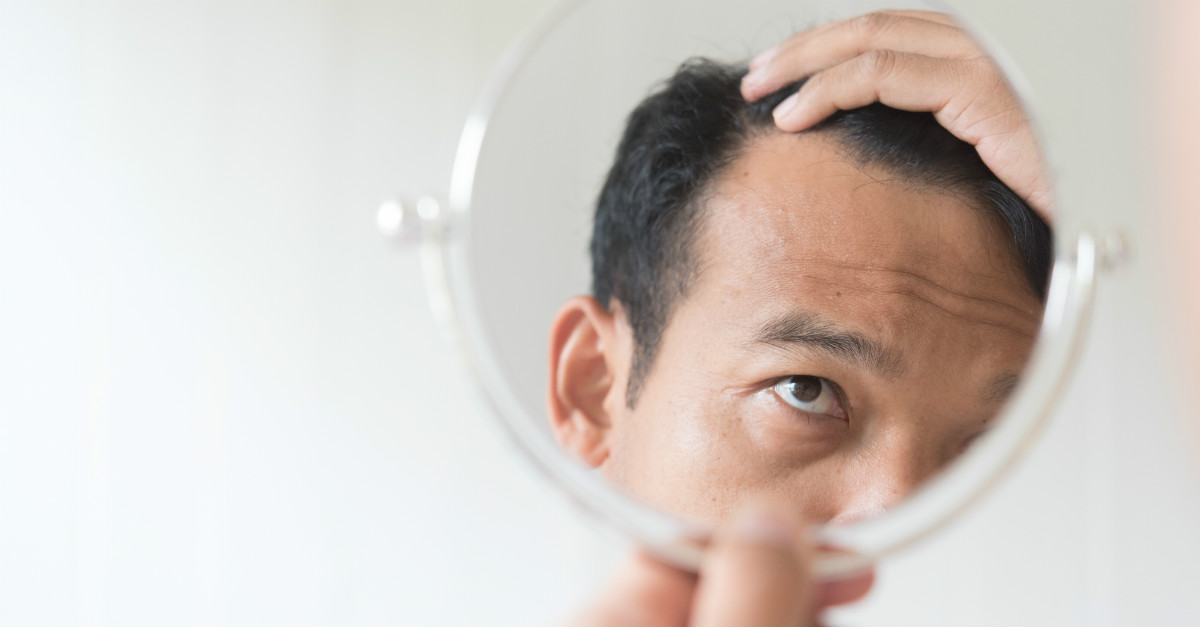 dicas caseiras retardar a calvicie