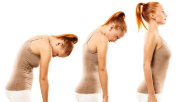 como corrigir a postura