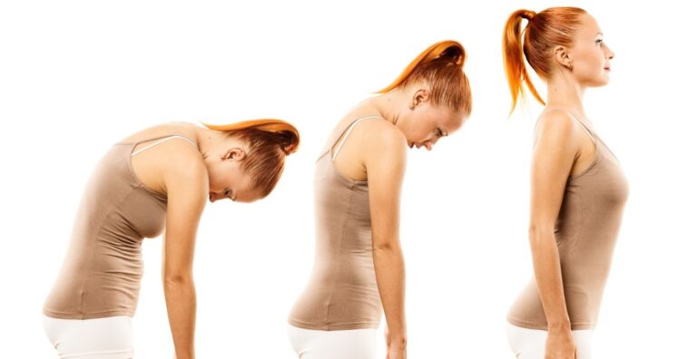 como corrigir a postura