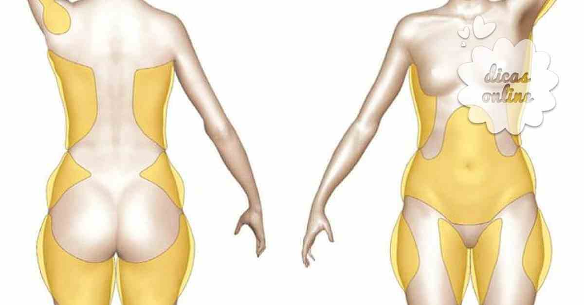 Dicas para emagrecer de forma saudável