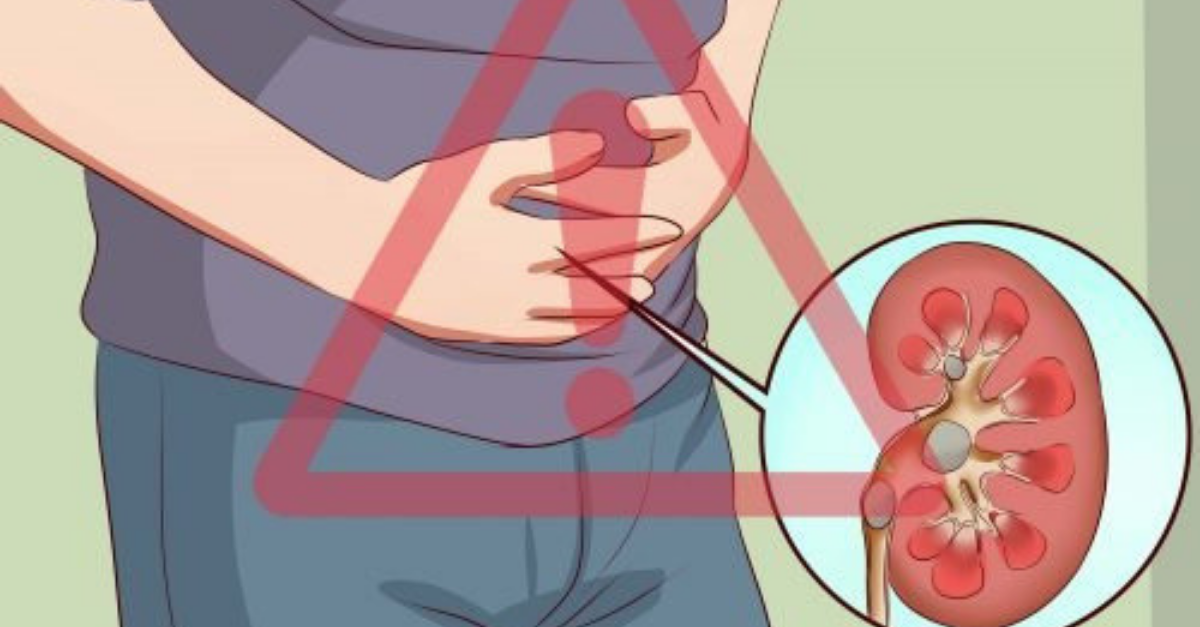 Dor nos rins como saber onde dói e o que fazer para tratar