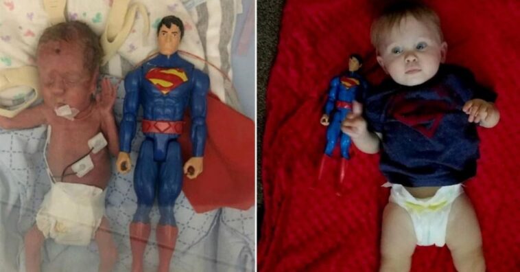 evolução de prematuro