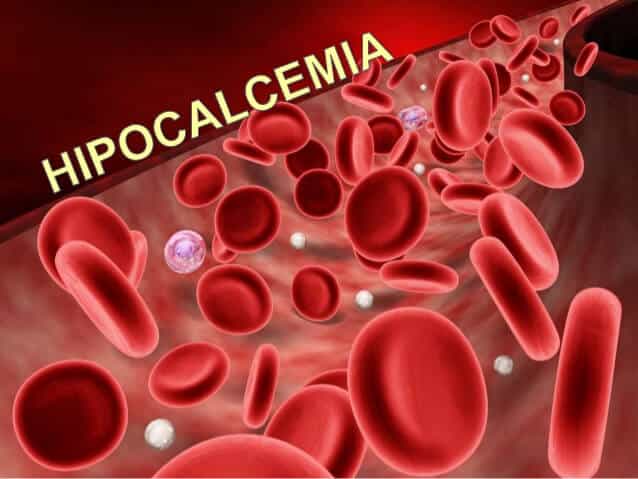 falta-de-calcio-sangue-hipocalcemia