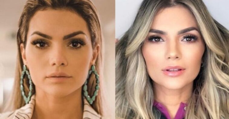famosos que fizeram harmonização facial