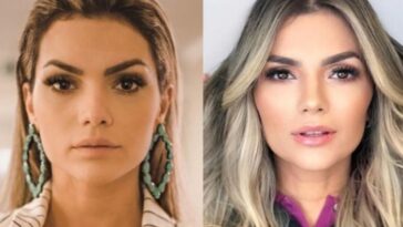 famosos que fizeram harmonização facial