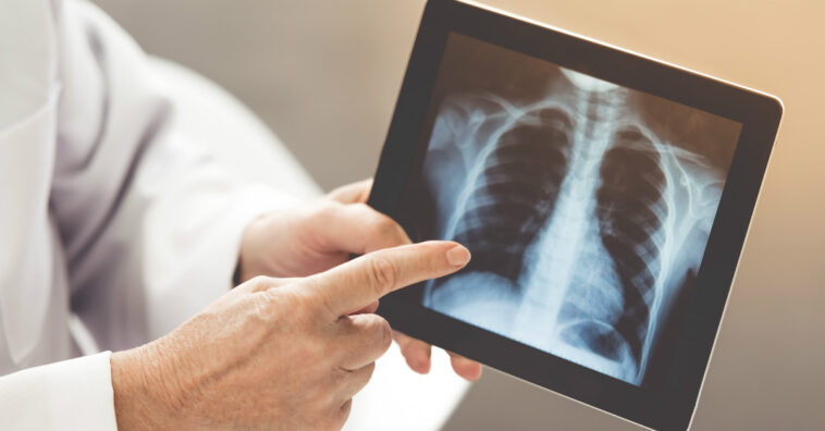 como fortalecer os pulmões