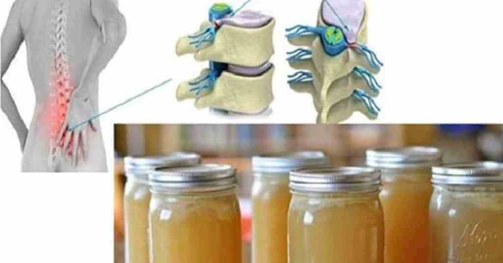 gelatina_-_articulacoes_-_novo_novo