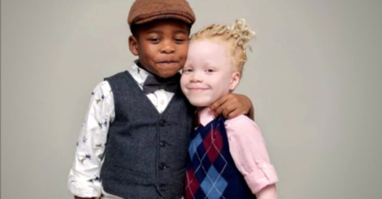 gemeos cor diferente