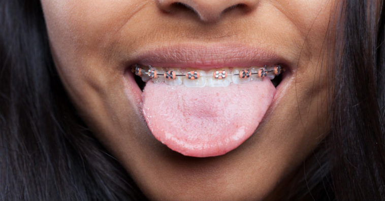 gosto metálico na boca como evitar