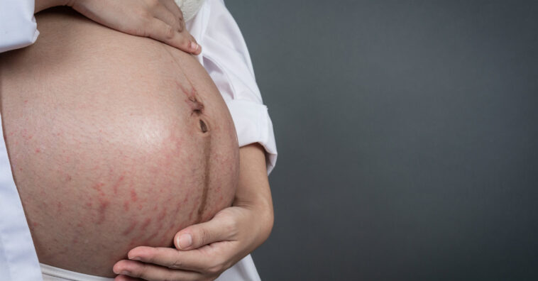 hemorragia pós-parto