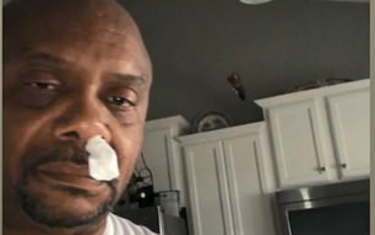 homem ignora nariz escorrendo história