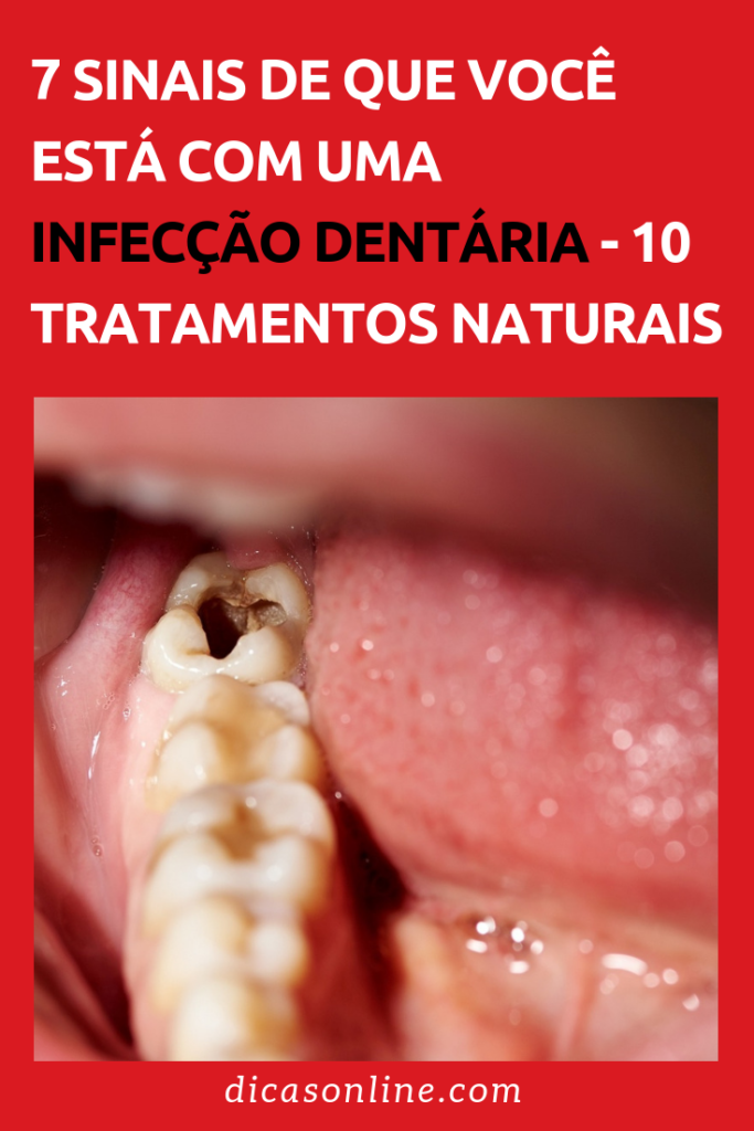 Infecção dentária: quais os sinais e como tratar