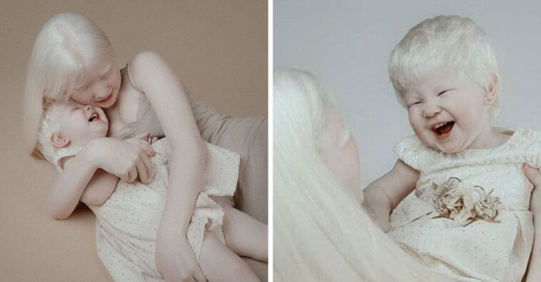 irmãs albinas
