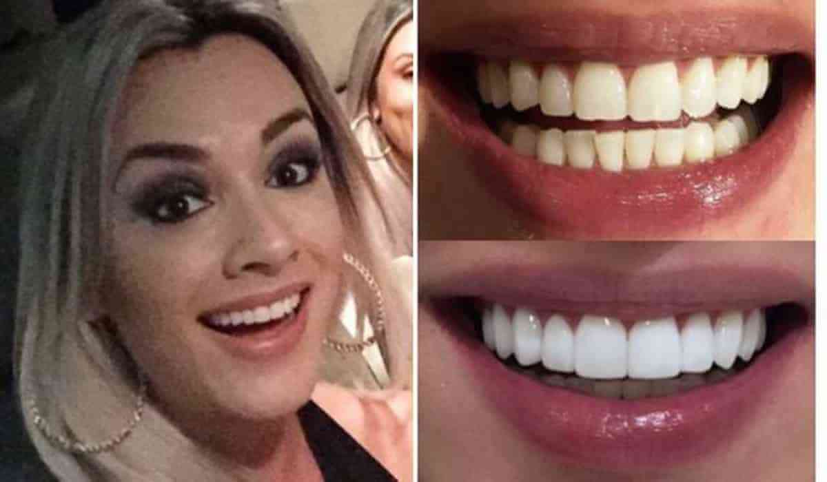 juju-salimeni-dentes_0