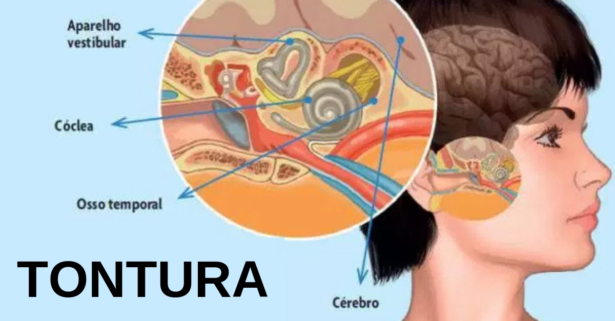Imagem sobre sintomas da labirintite emocional