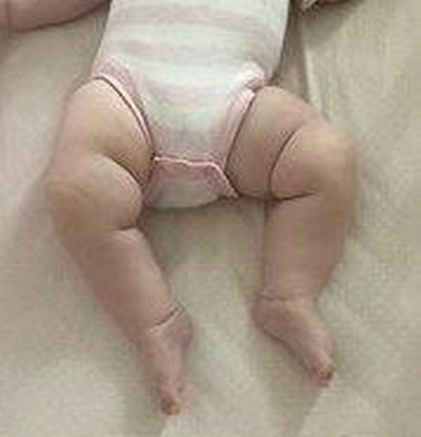 mãe recebe comentários maldosos sobre as pernas gordinhas do seu bebê