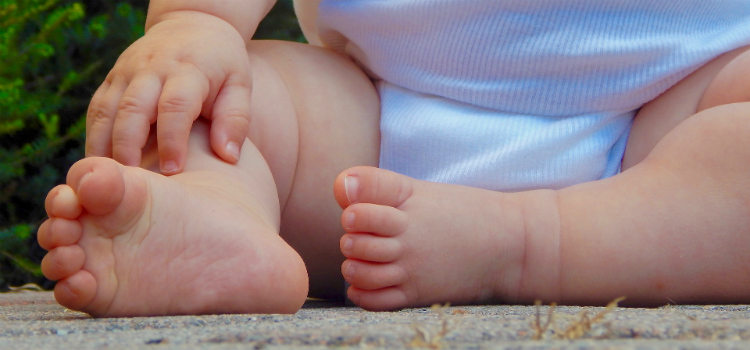 mãe recebe comentários maldosos sobre pernas do bebê