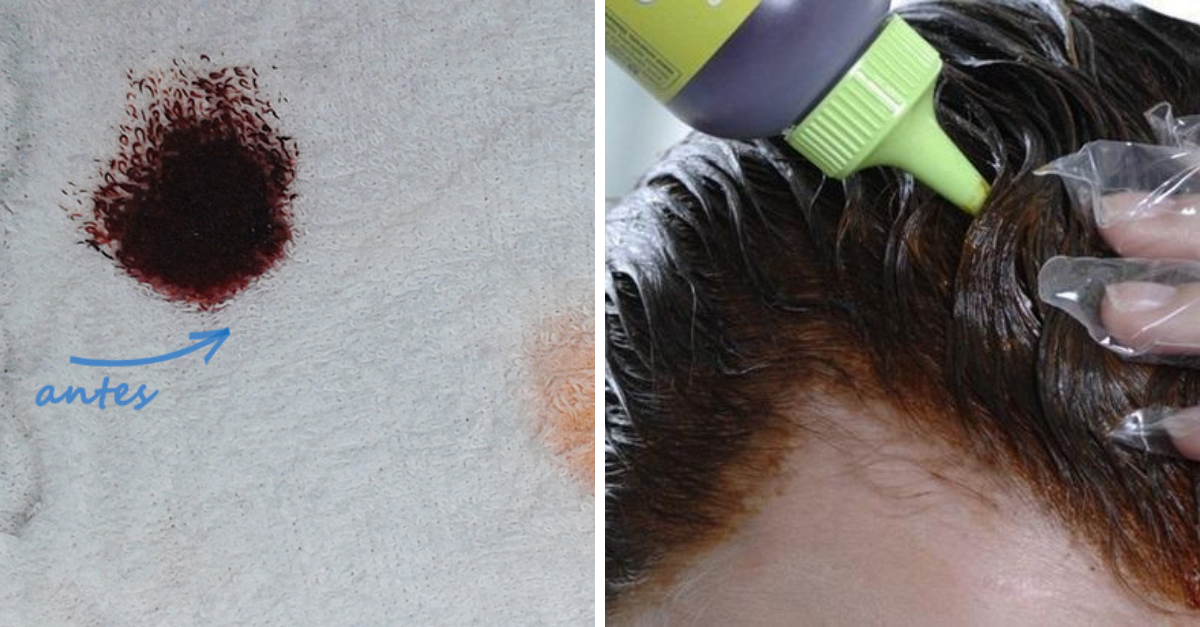 Como tirar mancha de tinta de cabelo das superfícies: 8 alternativas