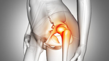 melhores exercícios para aumentar o quadril