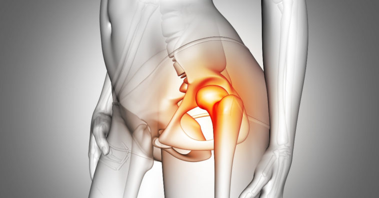 melhores exercícios para aumentar o quadril