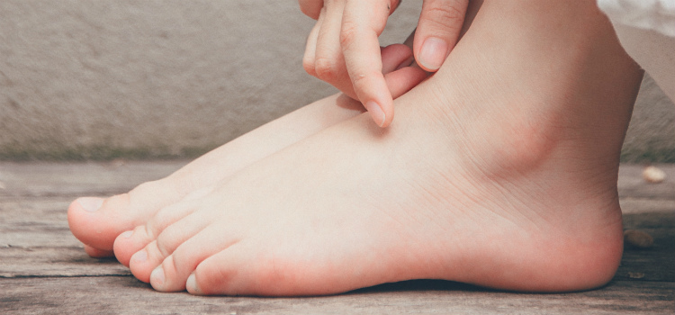 melhores remédios caseiros para pés inchados