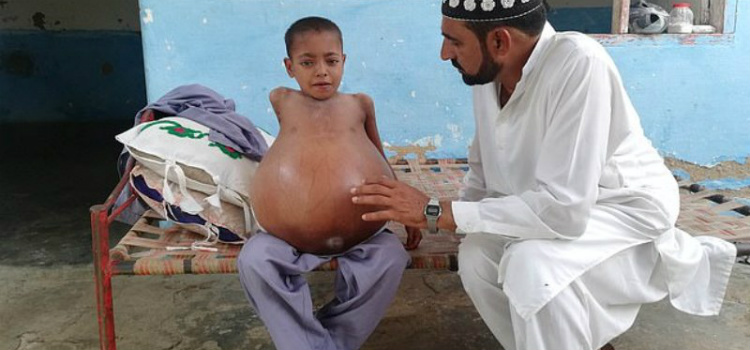 menino de 9 anos sofre agonia constante a historia