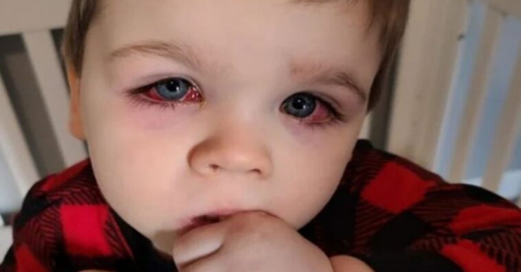 menino quase fica cego por causa de brinquedo mofado