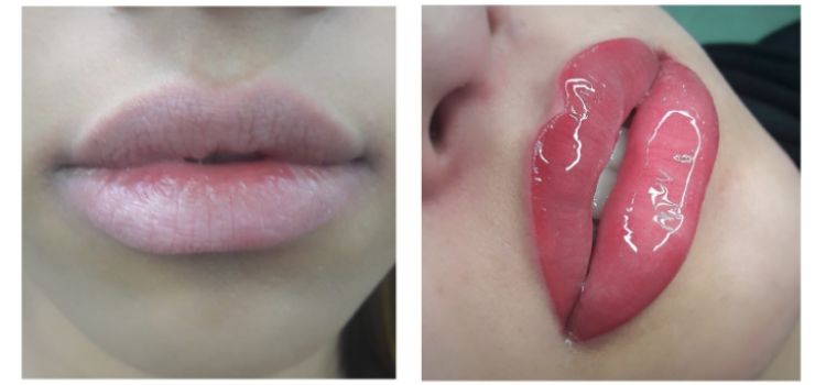 micropigmentação labial em labio grosso