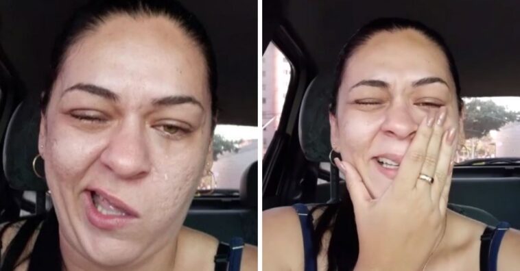 mulher faz vídeo com metade do rosto anestesiado após ir ao dentista