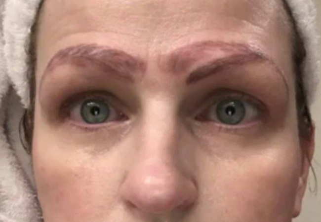 mulher fica com quatro sobrancelhas micropigmentacao
