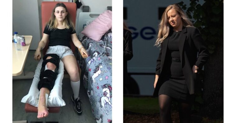 mulher quebra a perna e perde bebê brincadeira amiga