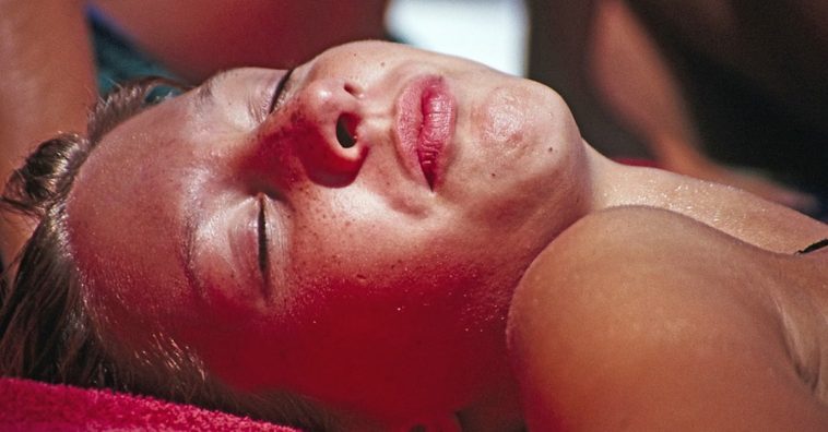 18 pessoas que sofreram com queimaduras de sol