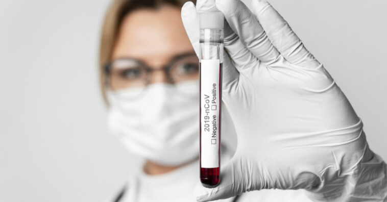 numeros coronavirus brasil