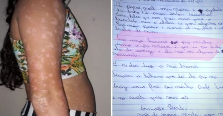 carta papai noel psoriase