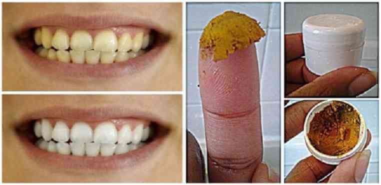 pasta-dental-curcuma