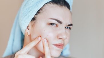 pasta de dente no rosto