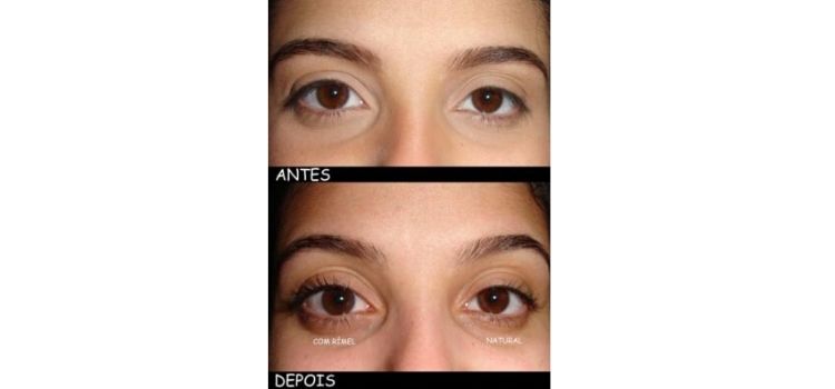 foto permanente com e sem mascara