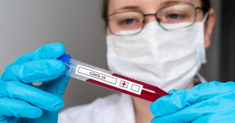 planos de saúde devem cobrir testes de covid