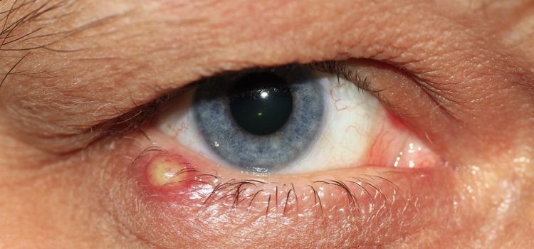as principais doenças com sintomas nos olhos
