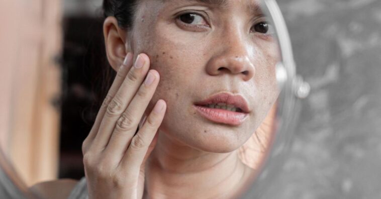 prosopagnosia o que é