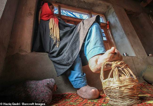 pés de mulher incham três vezes seu tamanho