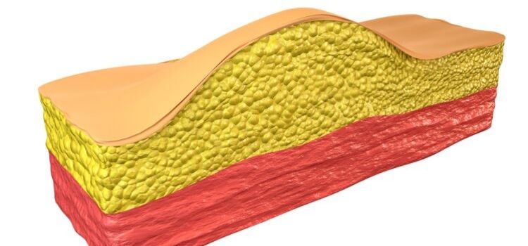 quais são os tratamentos para lipoma
