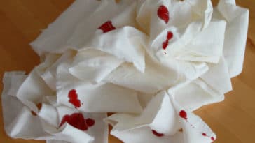 quais são os sintomas de hemorragia interna