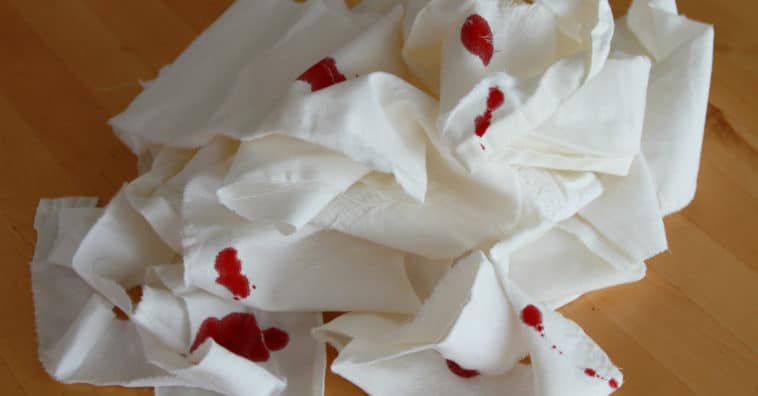 quais são os sintomas de hemorragia interna