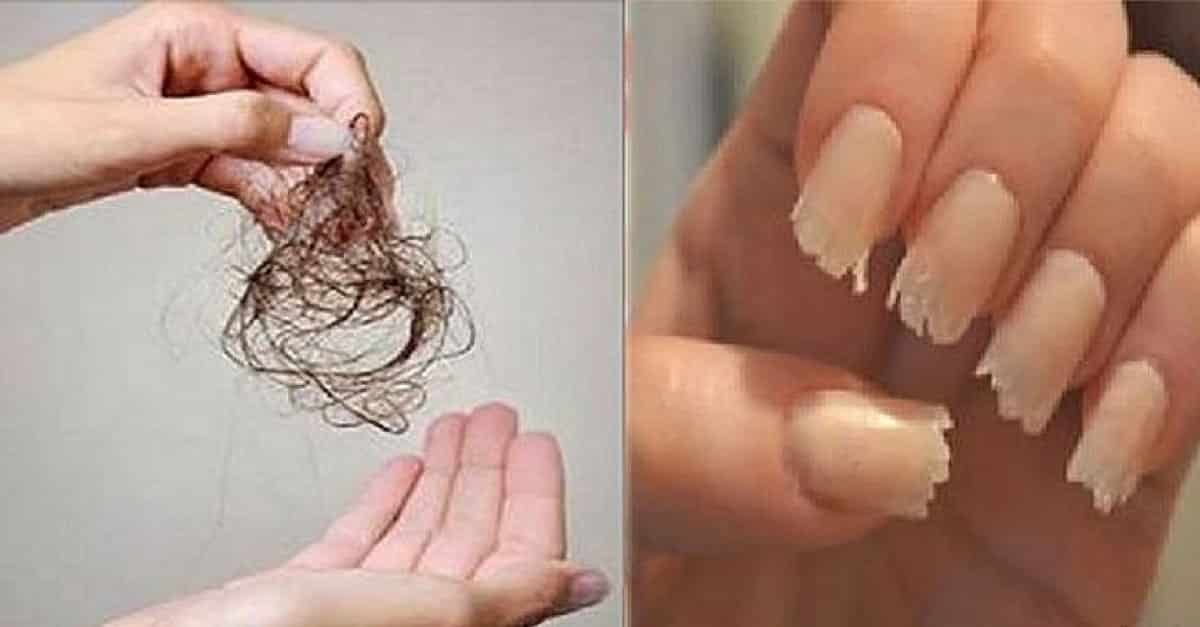 Conheça essa receita caseira para combater unhas fracas e queda de cabelo