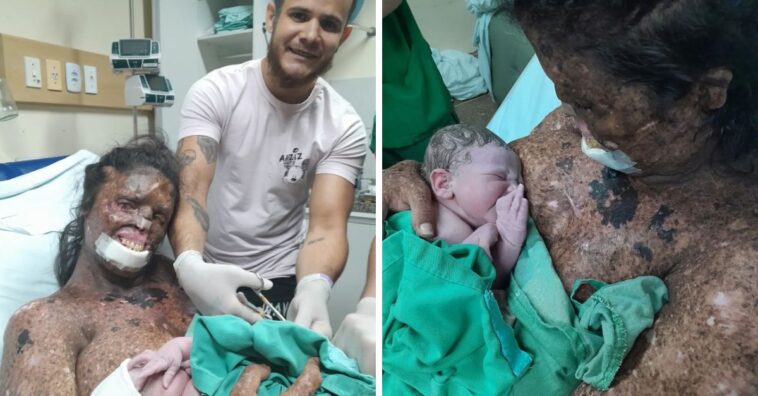 rara doença de pele